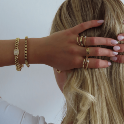 Alternative view of Shimmering Snake Ring